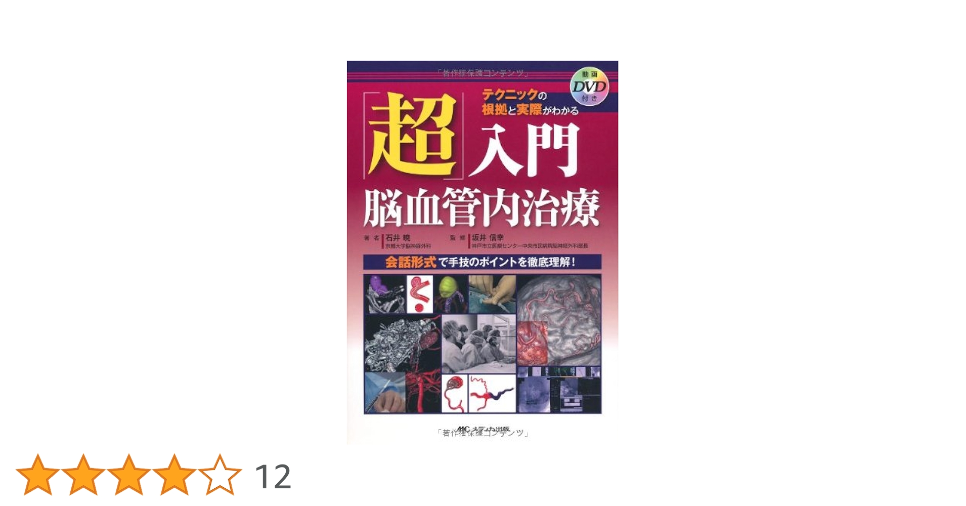 「超」入門脳血管内治療 セットアップ・血栓回収からFDまで会話形式で臨床のリア… 超」入門脳血管内治療 セットアップ・血栓回収からFDまで会話